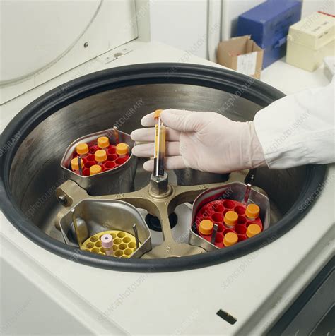 blood centrifuge|centrifuge used for separating blood.